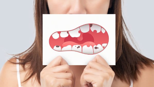beautiful, white teeth